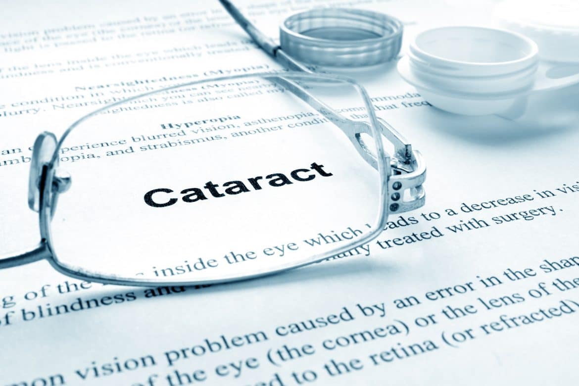 5 Questions to Clear up Myths vs. Realties about Cataracts