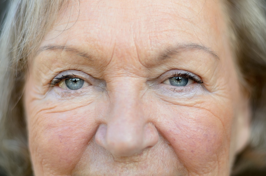 Can I Have Cataract Surgery On Both Eyes at One Time?