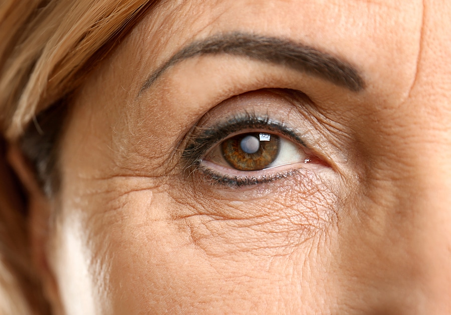 7 Early Signs of Cataracts to Take Seriously